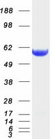 CORO1B Protein - Purified recombinant protein CORO1B was analyzed by SDS-PAGE gel and Coomassie Blue Staining