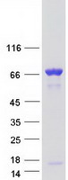 CORO1B Protein - Purified recombinant protein CORO1B was analyzed by SDS-PAGE gel and Coomassie Blue Staining