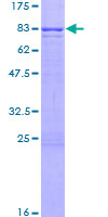 CORO1C Protein - 12.5% SDS-PAGE of human CORO1C stained with Coomassie Blue