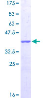 CORO1C Protein - 12.5% SDS-PAGE Stained with Coomassie Blue.