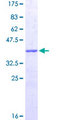 CORO1C Protein - 12.5% SDS-PAGE Stained with Coomassie Blue.