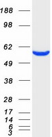 CORO1C Protein - Purified recombinant protein CORO1C was analyzed by SDS-PAGE gel and Coomassie Blue Staining