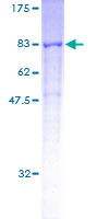 CORO2A Protein - 12.5% SDS-PAGE of human CORO2A stained with Coomassie Blue