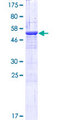 CORO6 Protein - 12.5% SDS-PAGE of human CORO6 stained with Coomassie Blue