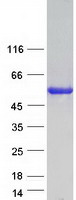 CORO6 Protein - Purified recombinant protein CORO6 was analyzed by SDS-PAGE gel and Coomassie Blue Staining