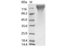 HKU1-CoV S1 Protein - Recombinant HCoV-HKU1 (Isolate N5) S1 Protein (His Tag)
