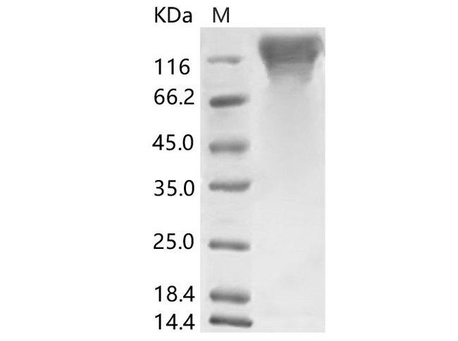 HKU1-CoV S1 Protein - Recombinant HCoV-HKU1 (Isolate N5) S1 Protein (His Tag)