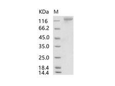 HKU1-CoV S1 Protein - Recombinant HCoV-HKU1 (Isolate N1) S1 Protein (His Tag)
