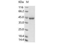 CoV NL63 Nucleoprotein Protein - Recombinant Human coronavirus (HCoV-NL63) Nucleoprotein / NP Protein (His Tag)