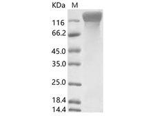 CoV NL63 Nucleoprotein Protein - Recombinant HCoV-NL63 S1 Protein (His Tag)