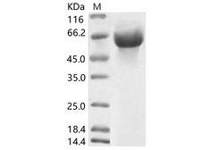 Coronavirus OC43 Protein - Recombinant HCoV-OC43 Hemagglutinin esterase Protein (His Tag)