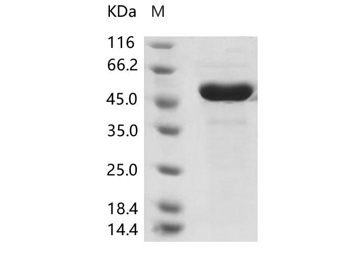 CoV OC43 Nucleoprotein Protein - Recombinant Human coronavirus (HCoV-OC43) Nucleoprotein / NP Protein (His Tag)
