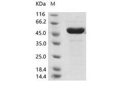 CoV OC43 Nucleoprotein Protein - Recombinant Human coronavirus (HCoV-OC43) Nucleoprotein / NP Protein (His Tag)
