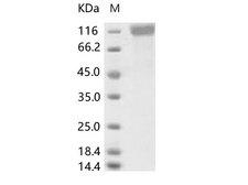 CoV OC43 Spike Glycoprotein Protein - Recombinant Human coronavirus (HCoV-OC43) Spike S1 Protein (His Tag)