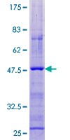 CORT / Cortistatin Protein - 12.5% SDS-PAGE of human CORT stained with Coomassie Blue