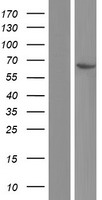 COT / CROT Protein - Western validation with an anti-DDK antibody * L: Control HEK293 lysate R: Over-expression lysate