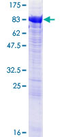 COT / CROT Protein - 12.5% SDS-PAGE of human CROT stained with Coomassie Blue