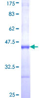 COT / CROT Protein - 12.5% SDS-PAGE Stained with Coomassie Blue.