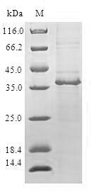 COT / CROT Protein - (Tris-Glycine gel) Discontinuous SDS-PAGE (reduced) with 5% enrichment gel and 15% separation gel.