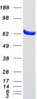 COT / CROT Protein - Purified recombinant protein CROT was analyzed by SDS-PAGE gel and Coomassie Blue Staining