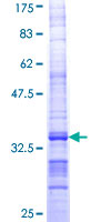 COX10 Protein - 12.5% SDS-PAGE Stained with Coomassie Blue.