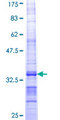COX10 Protein - 12.5% SDS-PAGE Stained with Coomassie Blue.