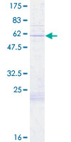 COX11 Protein - 12.5% SDS-PAGE of human COX11 stained with Coomassie Blue