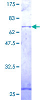 COX15 Protein - 12.5% SDS-PAGE of human COX15 stained with Coomassie Blue