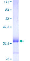 COX15 Protein - 12.5% SDS-PAGE Stained with Coomassie Blue.
