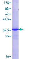 COX17 Protein - 12.5% SDS-PAGE of human COX17 stained with Coomassie Blue
