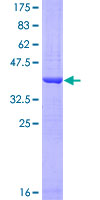 COX17 Protein - 12.5% SDS-PAGE Stained with Coomassie Blue.