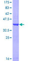 COX17 Protein - 12.5% SDS-PAGE Stained with Coomassie Blue.