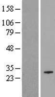 COX18 Protein - Western validation with an anti-DDK antibody * L: Control HEK293 lysate R: Over-expression lysate