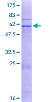COX18 Protein - 12.5% SDS-PAGE of human COX18 stained with Coomassie Blue