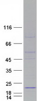 COX20 Protein - Purified recombinant protein COX20 was analyzed by SDS-PAGE gel and Coomassie Blue Staining