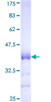 COX4I2 Protein - 12.5% SDS-PAGE Stained with Coomassie Blue.