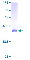 COX5A Protein - 12.5% SDS-PAGE of human COX5A stained with Coomassie Blue