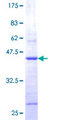 COX5B Protein - 12.5% SDS-PAGE of human COX5B stained with Coomassie Blue