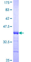 COX5B Protein - 12.5% SDS-PAGE Stained with Coomassie Blue.