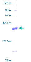 COX6A1 Protein - 12.5% SDS-PAGE of human COX6A1 stained with Coomassie Blue