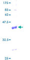 COX6A1 Protein - 12.5% SDS-PAGE of human COX6A1 stained with Coomassie Blue