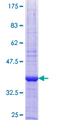 COX6B2 Protein - 12.5% SDS-PAGE of human COX6B2 stained with Coomassie Blue