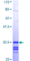 COX7A2 Protein - 12.5% SDS-PAGE Stained with Coomassie Blue.
