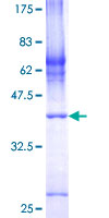 COX7A2L Protein - 12.5% SDS-PAGE of human COX7A2L stained with Coomassie Blue