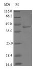 COX7A2L Protein - (Tris-Glycine gel) Discontinuous SDS-PAGE (reduced) with 5% enrichment gel and 15% separation gel.
