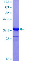 COX7A2L Protein - 12.5% SDS-PAGE Stained with Coomassie Blue.