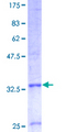 COX7B Protein - 12.5% SDS-PAGE of human COX7B stained with Coomassie Blue