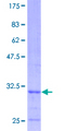 COX7C Protein - 12.5% SDS-PAGE of human COX7C stained with Coomassie Blue