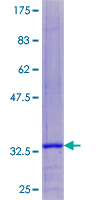 COX8A Protein - 12.5% SDS-PAGE of human COX8A stained with Coomassie Blue