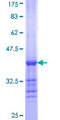 COXG / COX6B1 Protein - 12.5% SDS-PAGE Stained with Coomassie Blue.